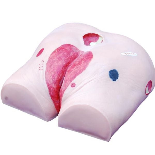 Dekübit Ülser Bakımı Eğitim Modeli