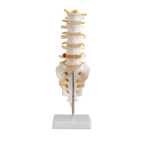 Lumbar Vertebra (Sakrum Koksiks ve Fıtıklı) Modeli