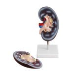 Böbrek Modeli 2 Parça - Görsel 2