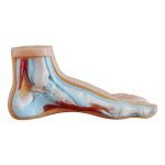 Patolojik (Normal Düz ve Kemerli) Ayak Modelleri 3 Parça - Görsel 2