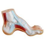 Patolojik (Normal Düz ve Kemerli) Ayak Modelleri 3 Parça - Görsel 4